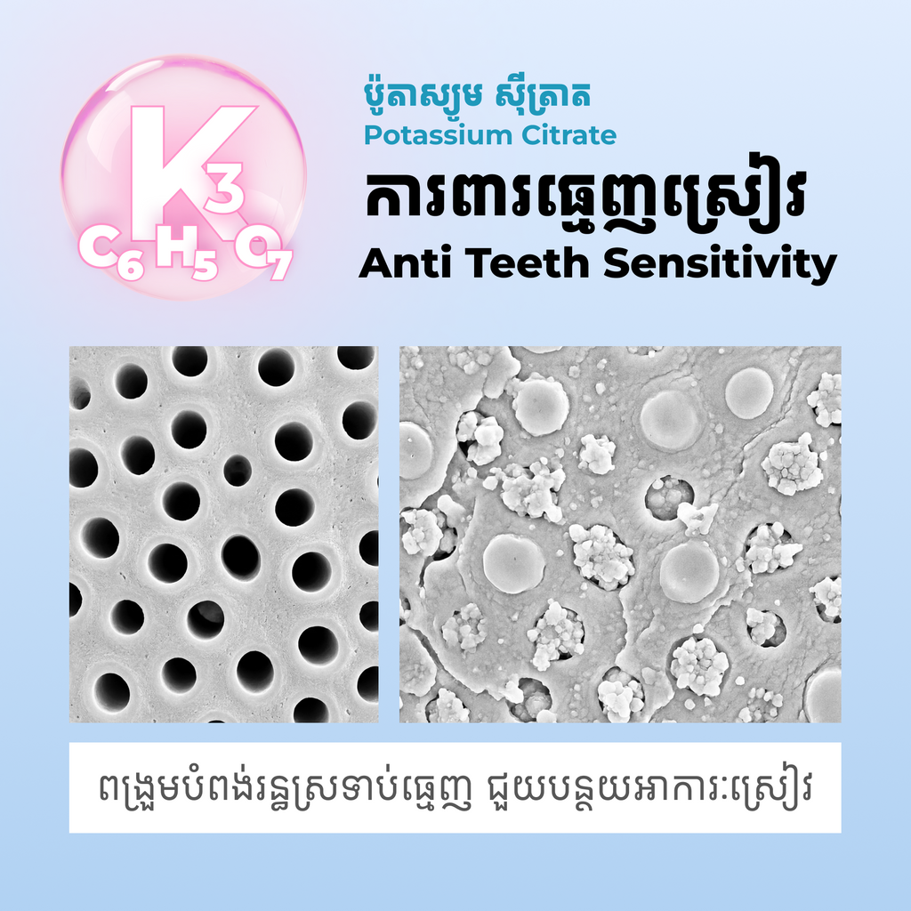 Smilelab Whitening Toothpaste with 6 Benefits